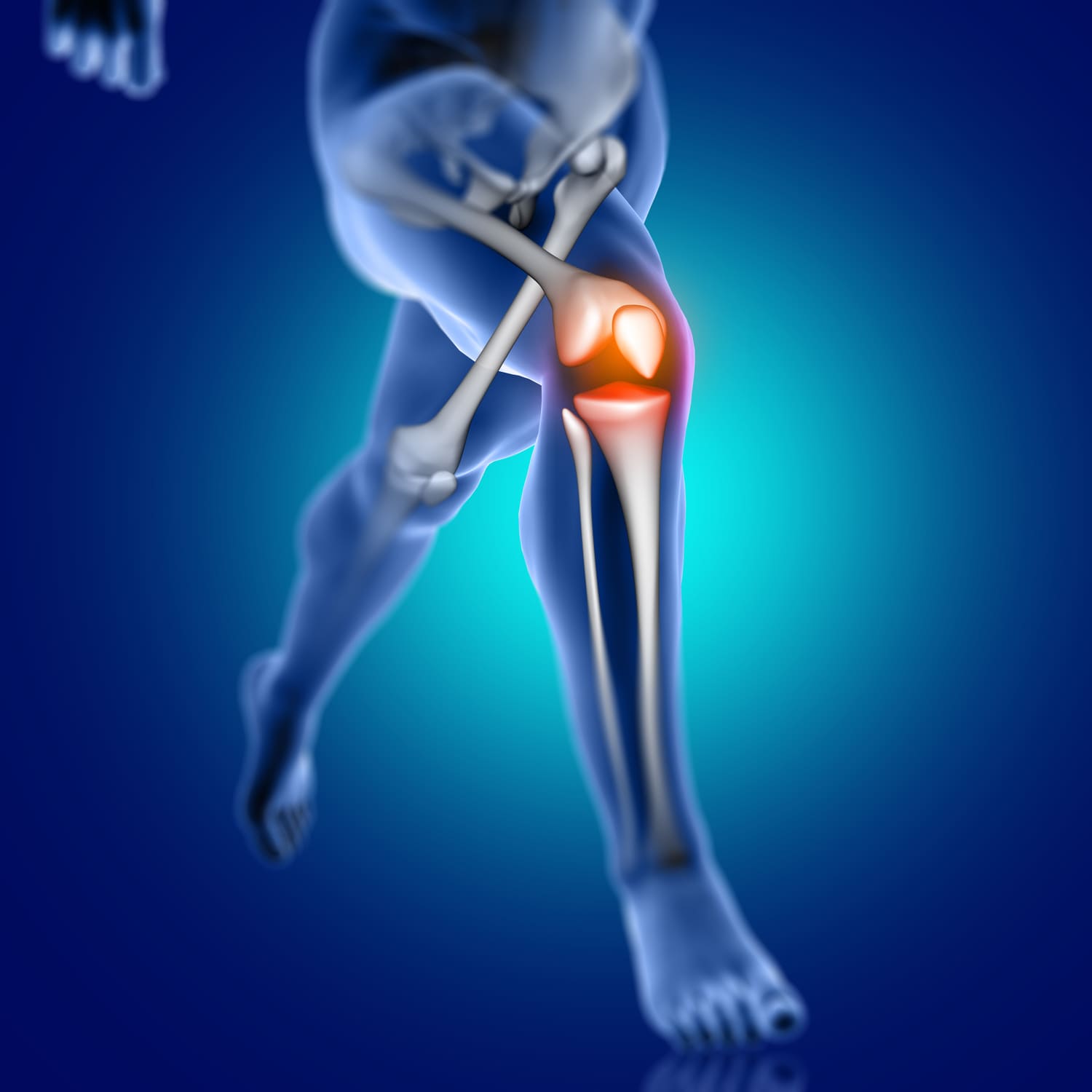 Reemplazos de rodilla - cadera